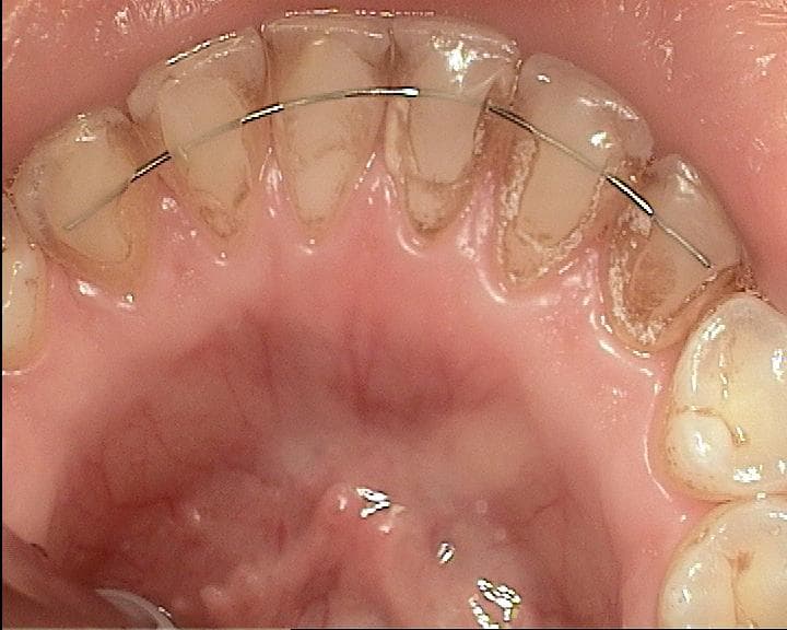 Gercek alt ark agiz ici fotograf ornegi